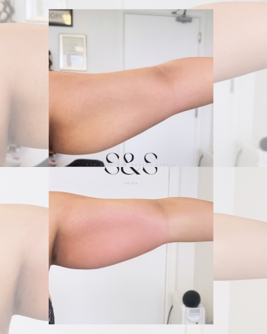 1 Session Bingo Wing Reduction